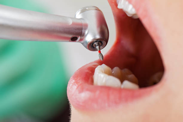 Best Emergency Treatment for Dental Infections or Abscesses in East Tawas, MI
